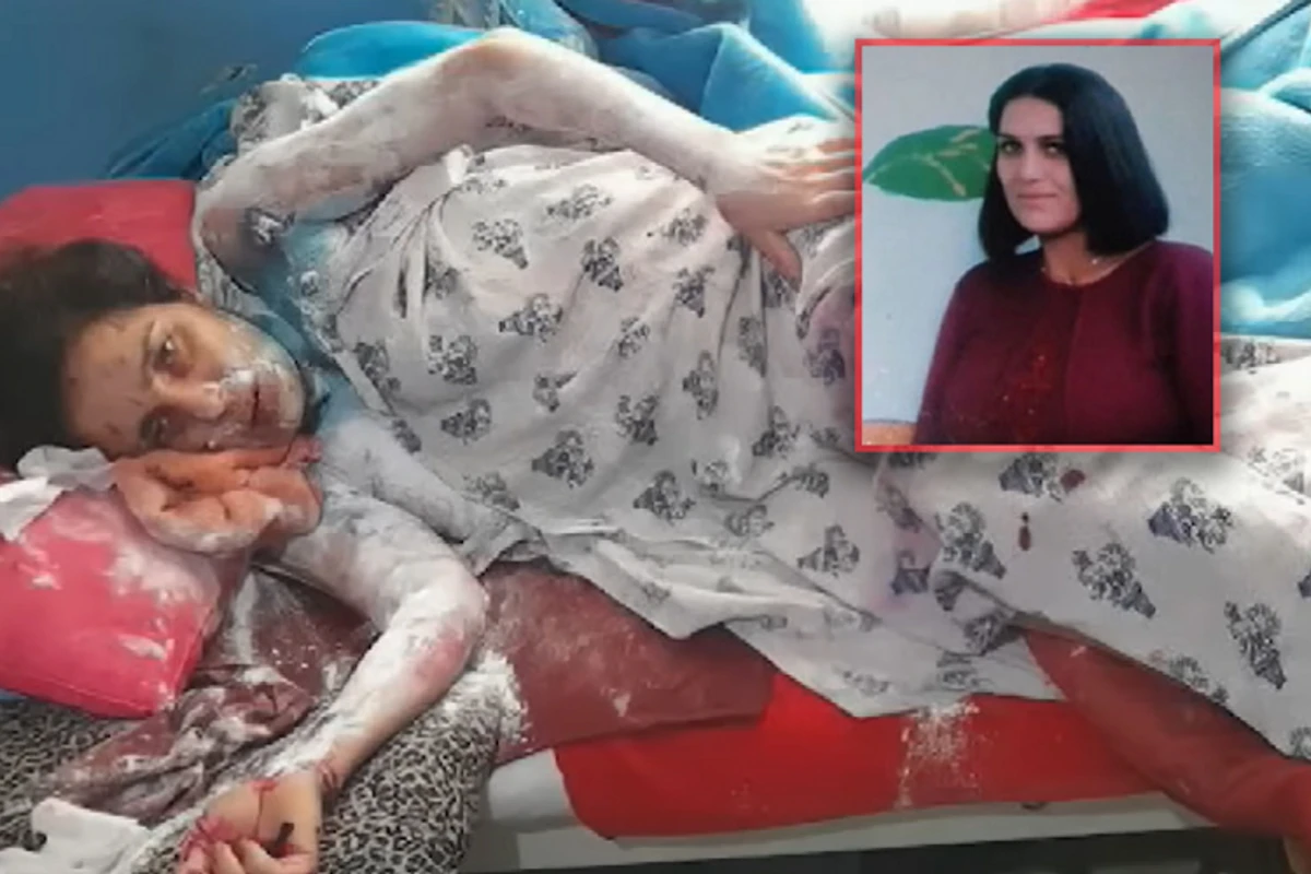 Azərbaycanda gəlinini kimyəvi maddə ilə yandıran qayınata: Yaxşı eləmişəm - VİDEO