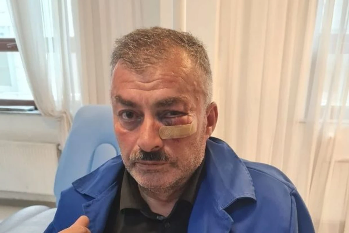 Borclu abonent yaba ilə “Azəriqaz”ın işçilərini HƏDƏLƏDİ: Birini yaraladı - FOTO