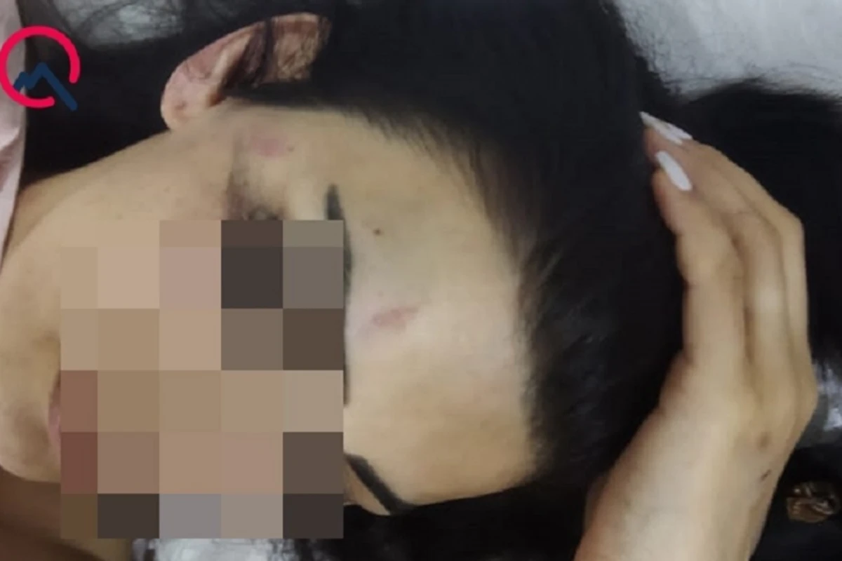 В Баку мужчина ранил ножом пожелавшую развестись с ним супругу - ФОТО