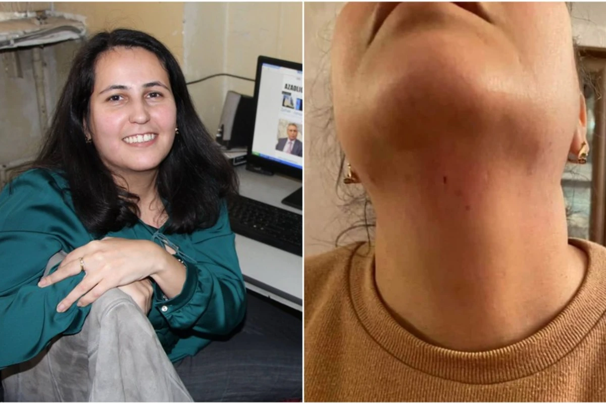 Jurnalist Aytən Məmmədovaya hücumla bağlı cinayət işi başlanılıb