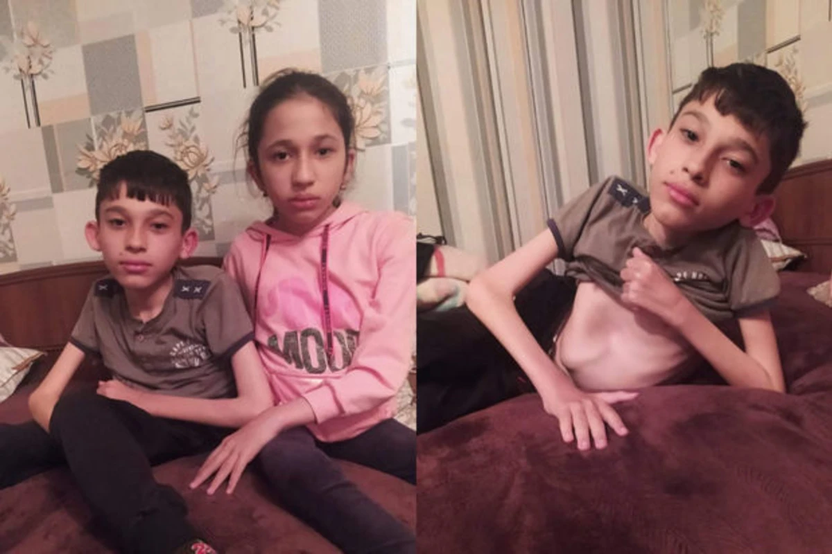 SMA xəstəsi olan bacı-qardaşın sizin köməyinizə ehtiyacı var – FOTO