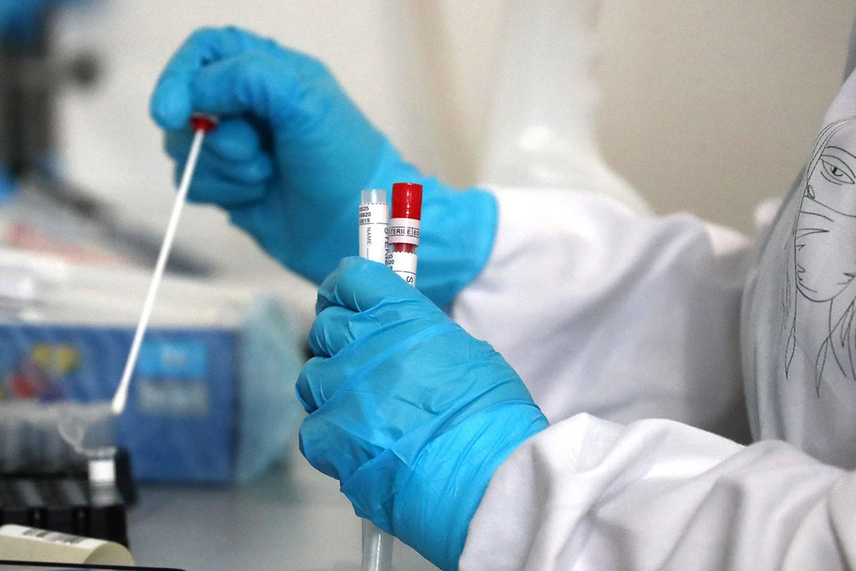 Azərbaycanda son sutkada koronavirusa yoluxanların statistikası