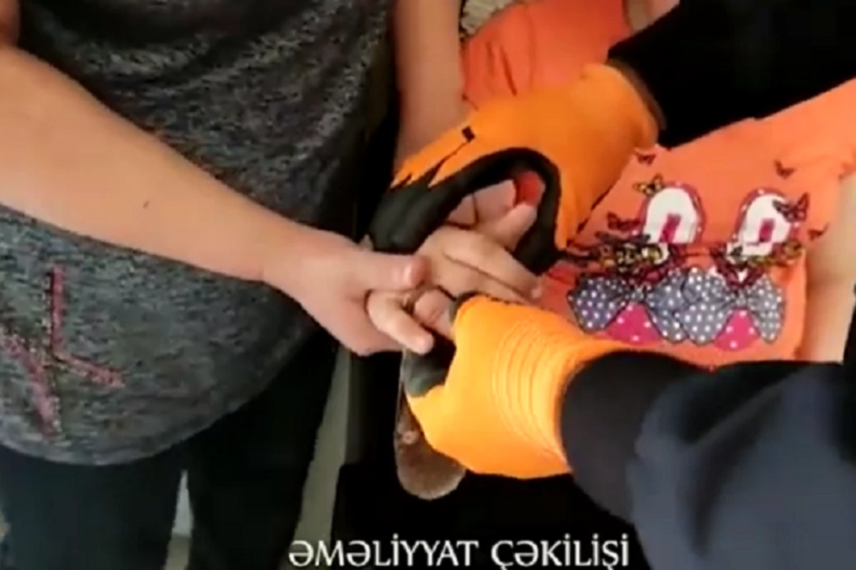 10 yaşlı uşağın barmağında qalan dəmir halqa belə çıxarıldı - VİDEO