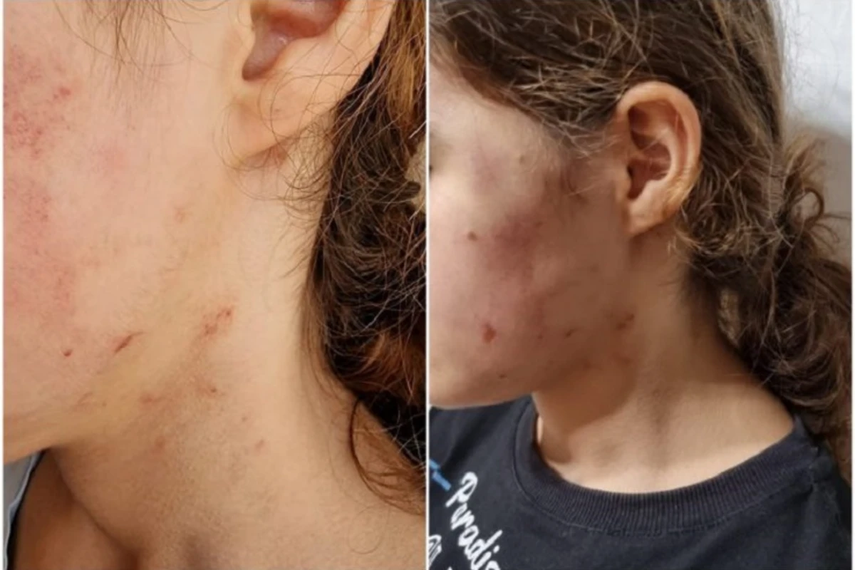 Azərbaycanda vəzifəli şəxslərin məktəblini döyməsi faktı təsdiqini tapdı