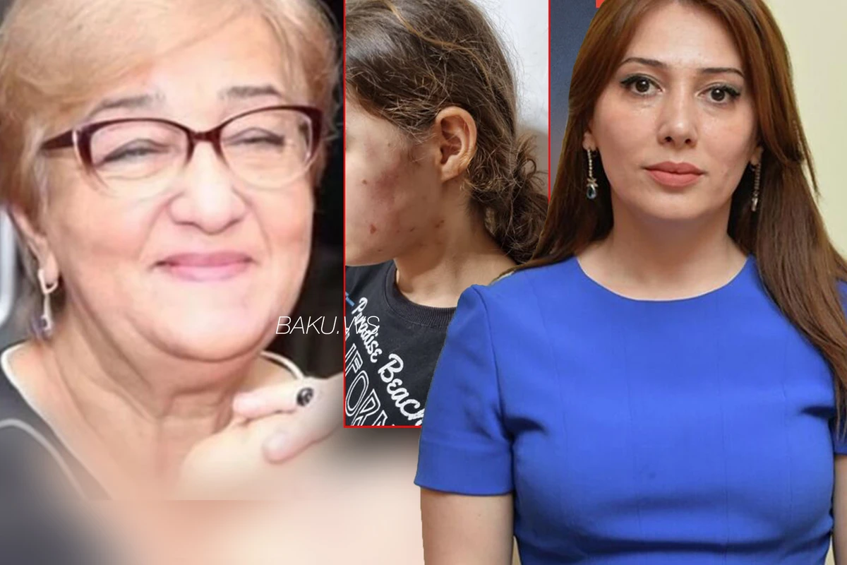 Lənkəranda döyülən 15 yaşlı qız sığınacağa YERLƏŞDİRİLƏCƏK