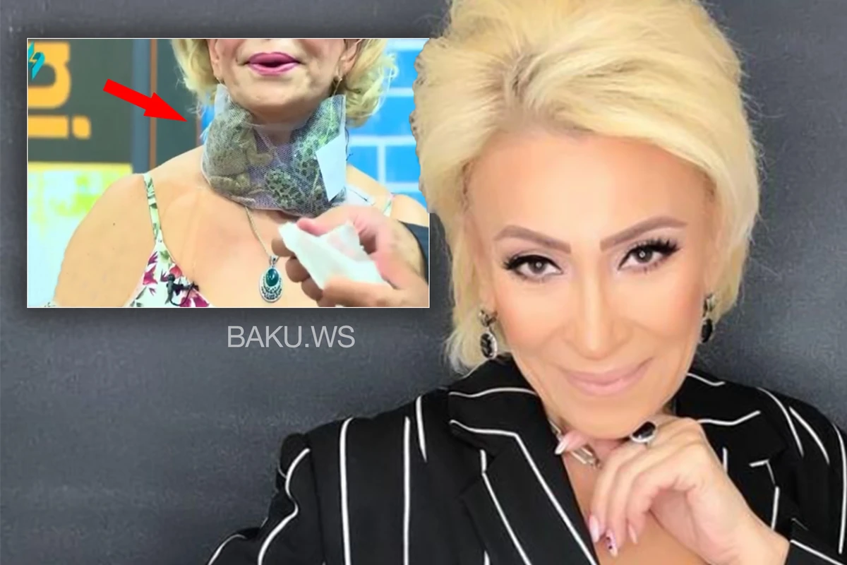 Əməkdar artistin boğazına qurbağa bağladılar - FOTO