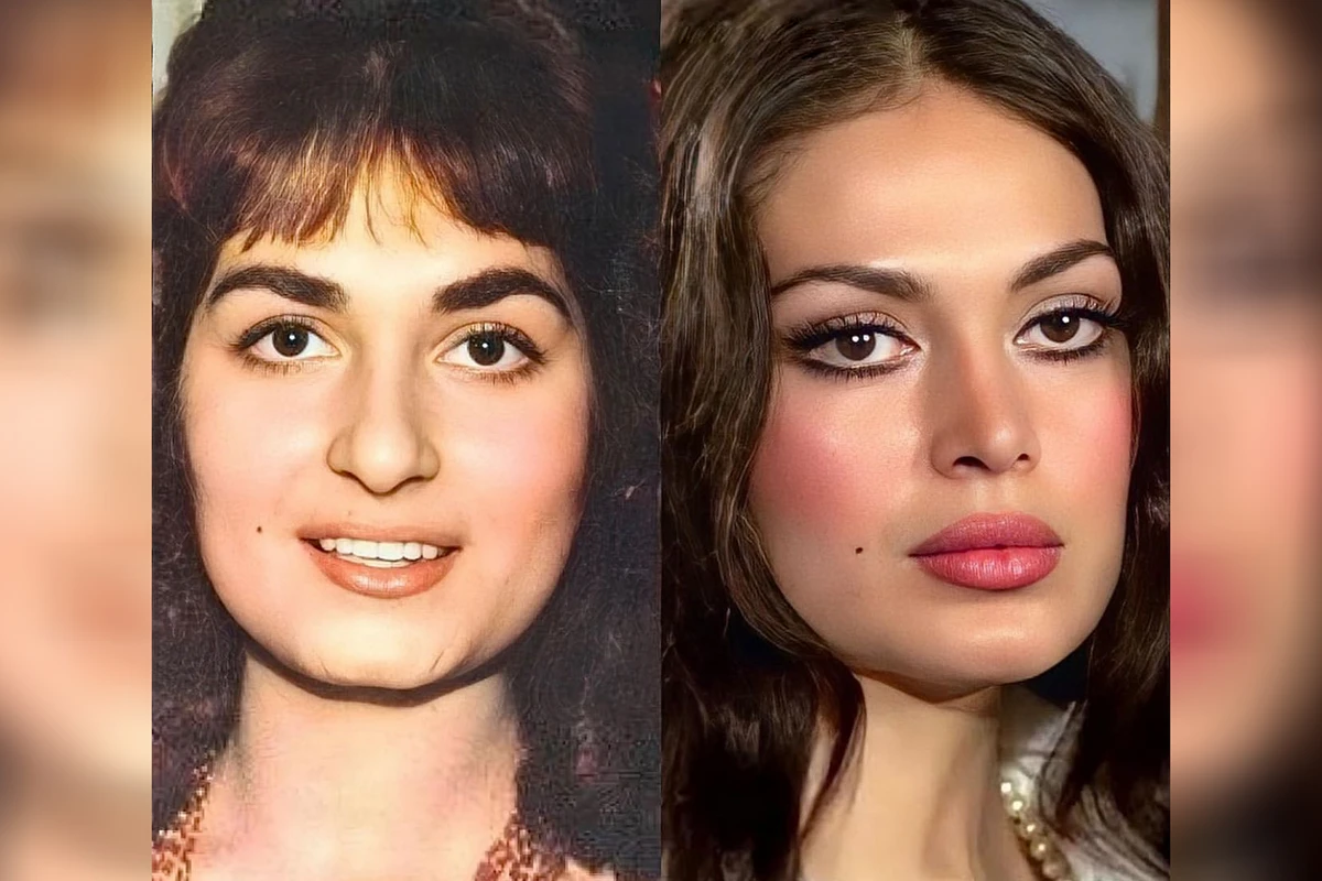 Türkan Şorayı dəyişdirən PLASTİK ƏMƏLİYYATLAR VƏ QİYMƏTLƏRİ - FOTO