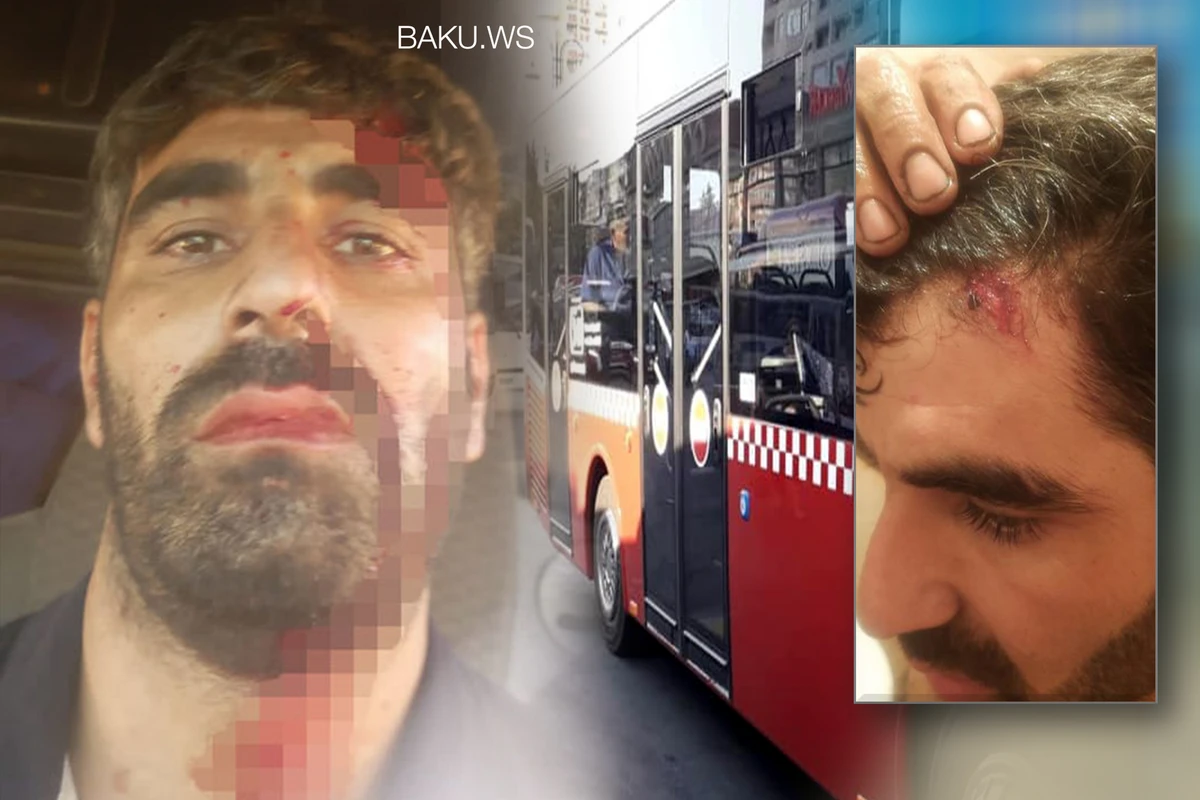Bakıda avtobus xəttində şirkətin elektriki döyüldü - ŞİKAYƏT - FOTO