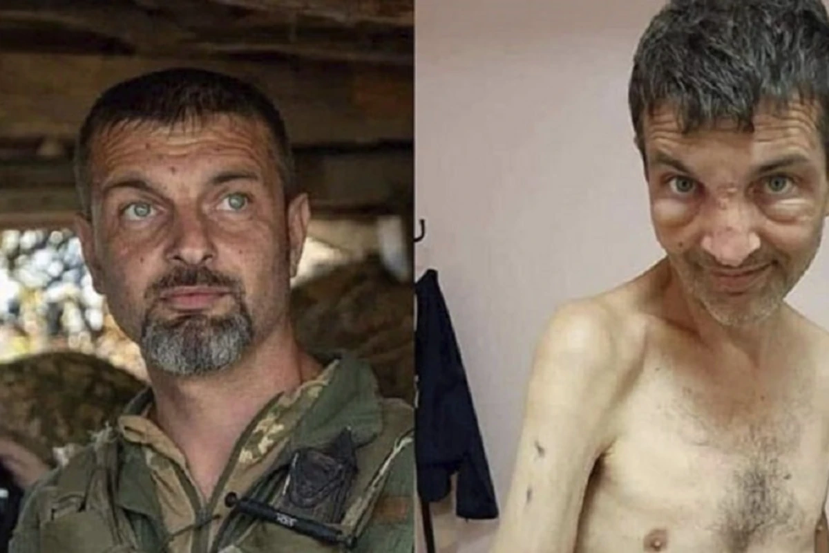 4 ay Rusiya əsirliyi “Azov döyüşçüsü”nü tanınmaz hala saldı - FOTO