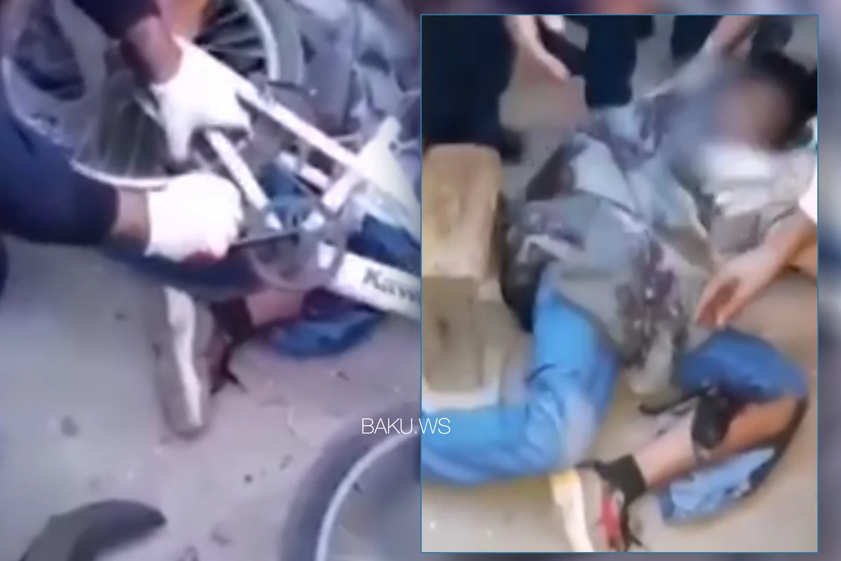 Velosiped 12 yaşlı oğlanın ayağını kəsdi - VİDEO