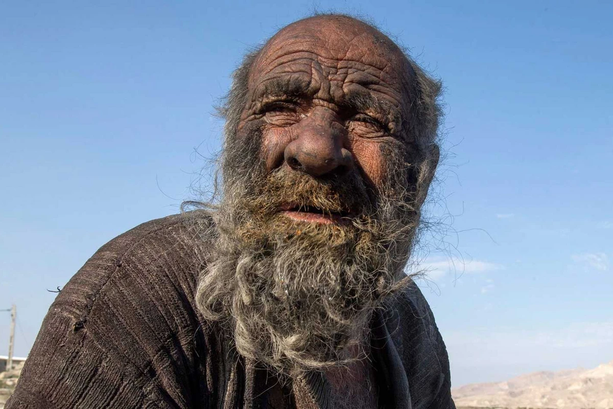 50 ildən çoxdur duş qəbul etməyən kişi çiməndən sonra öldü
