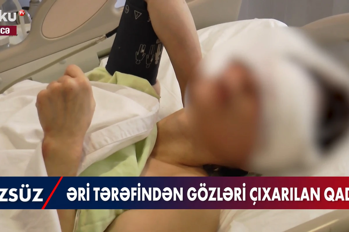 Əri tərəfindən gözləri çıxarılan qadının  GÖRÜNTÜLƏRİ - VİDEO