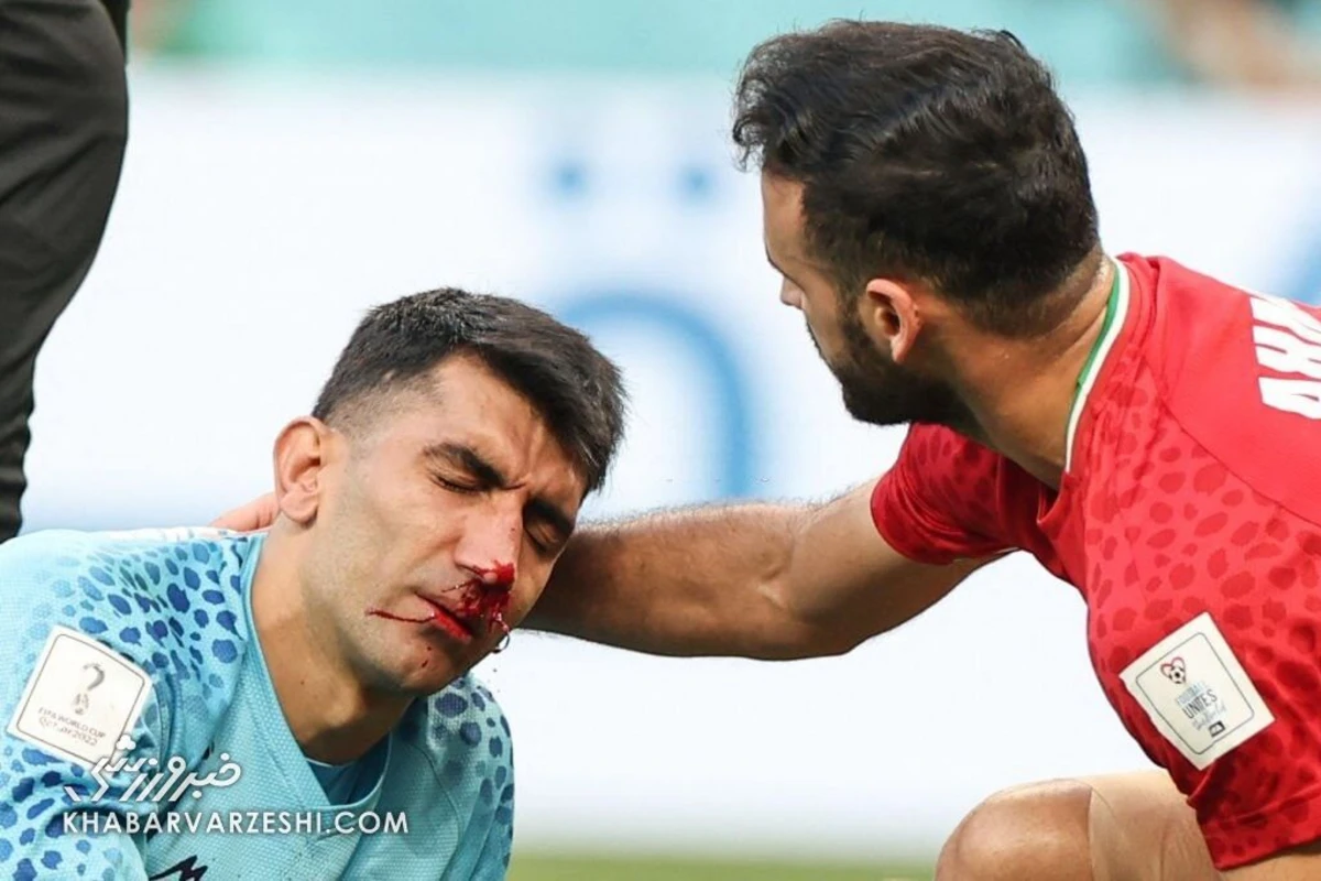 İran millisinin qapıçısı üçün mundial başa çatıb