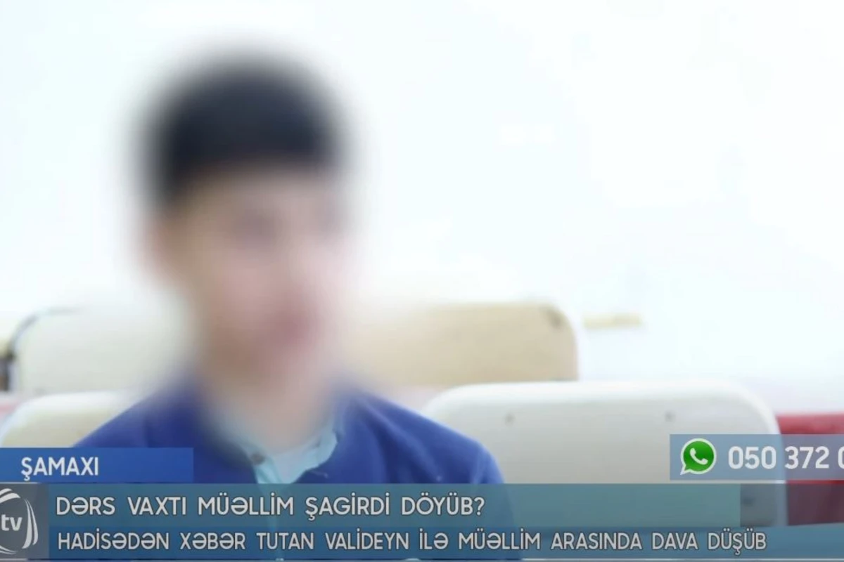 “Başımı lövhəyə, sonra tumbuçkaya vurdu”- Müəllimin döydüyü deyilən şagird DANIŞDI - VİDEO