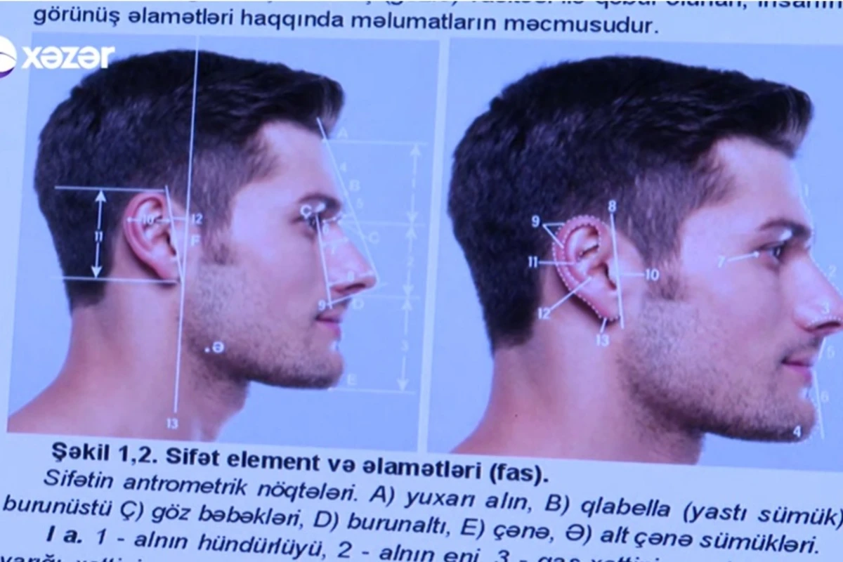 Cinayətkarların ŞOK ÜSULU: məsuliyyətdən yayınmaq üçün plastik əməliyyata girirlər - VİDEO