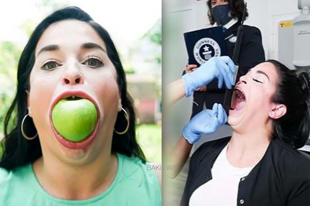 Ağzının böyüklüyünə görə “Ginnesin Rekordlar Kitabı”na düşdü -  FOTO