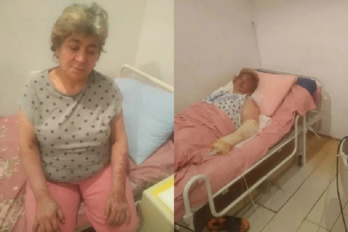 Qaz partlayışından xəsarət alan qadının qızı: “Anamın yenidən ayağa qalxması üçün bizə kömək edin” - FOTO