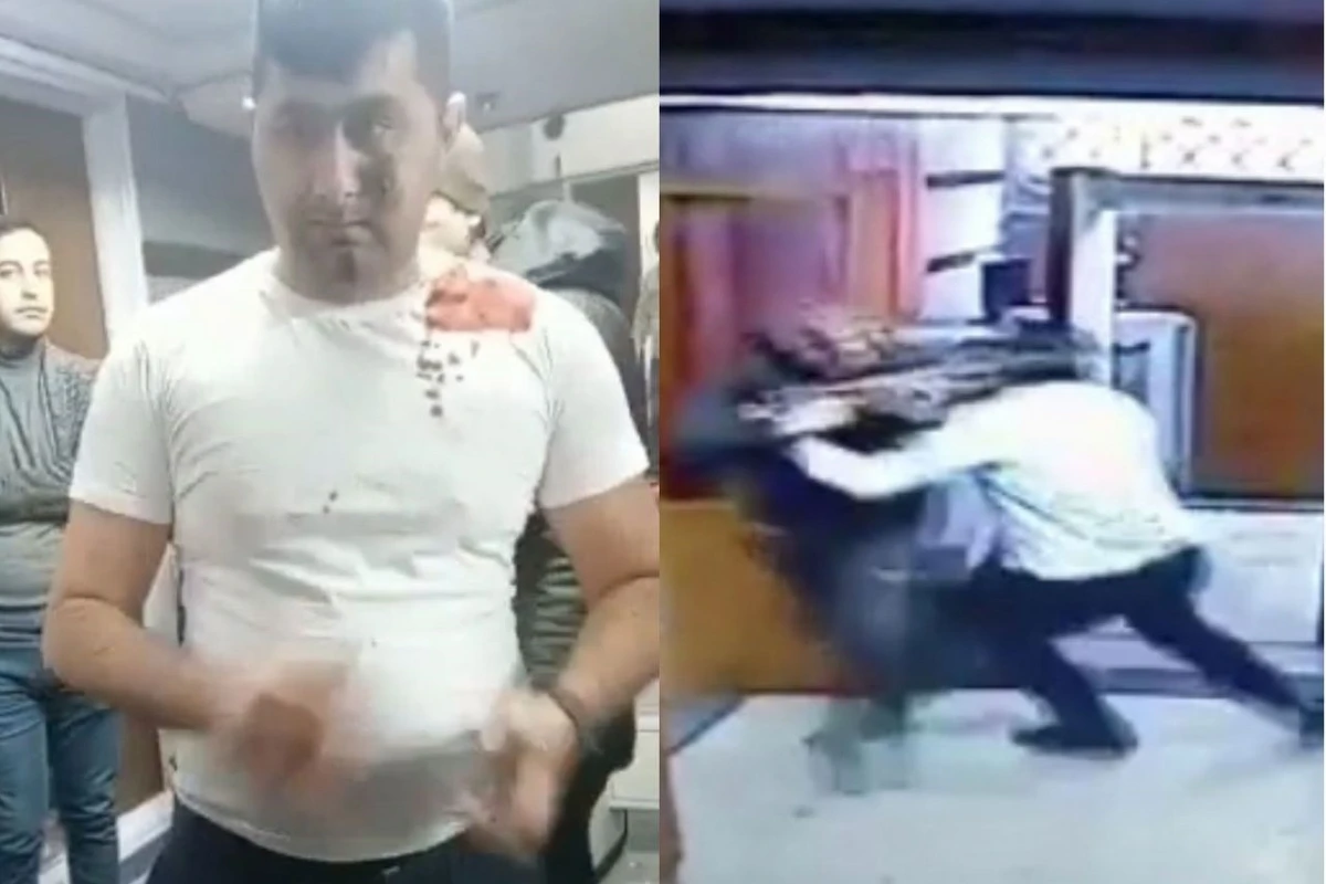 Səfirlikdə terrorçunu zərərsizləşdirən Vasif Tağıyevin əməliyyatdan sonra ilk görüntüsü - FOTO