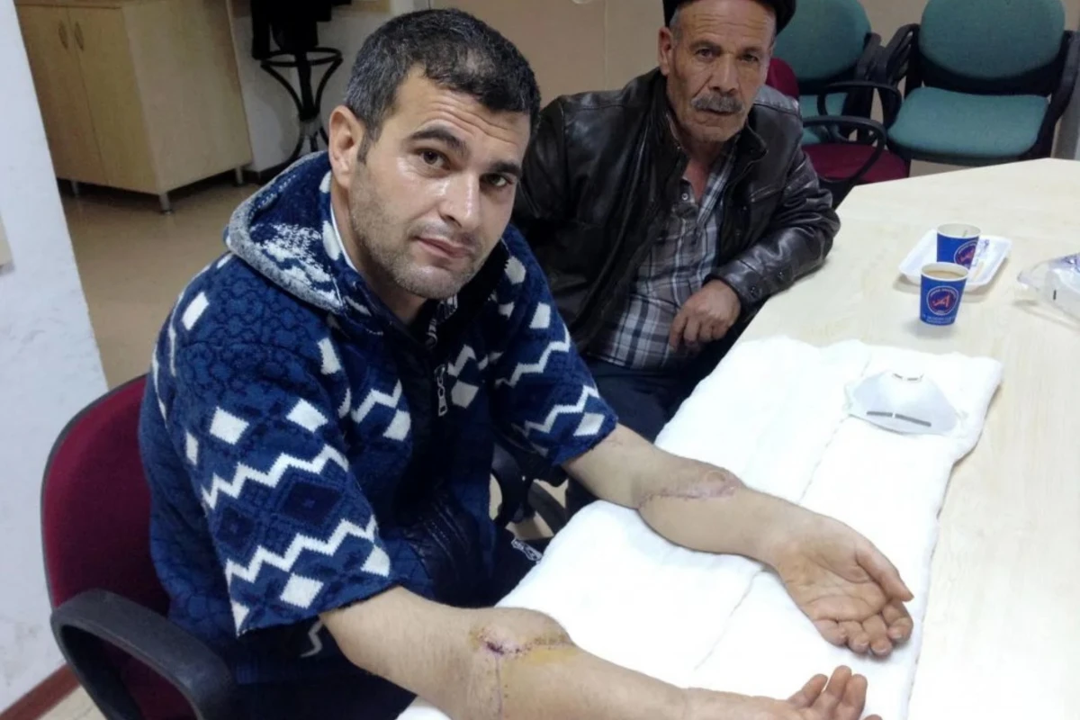 7 il öncə hər iki qolu transplantasiya olunan kişi dağıntılar altında qalaraq öldü - FOTO
