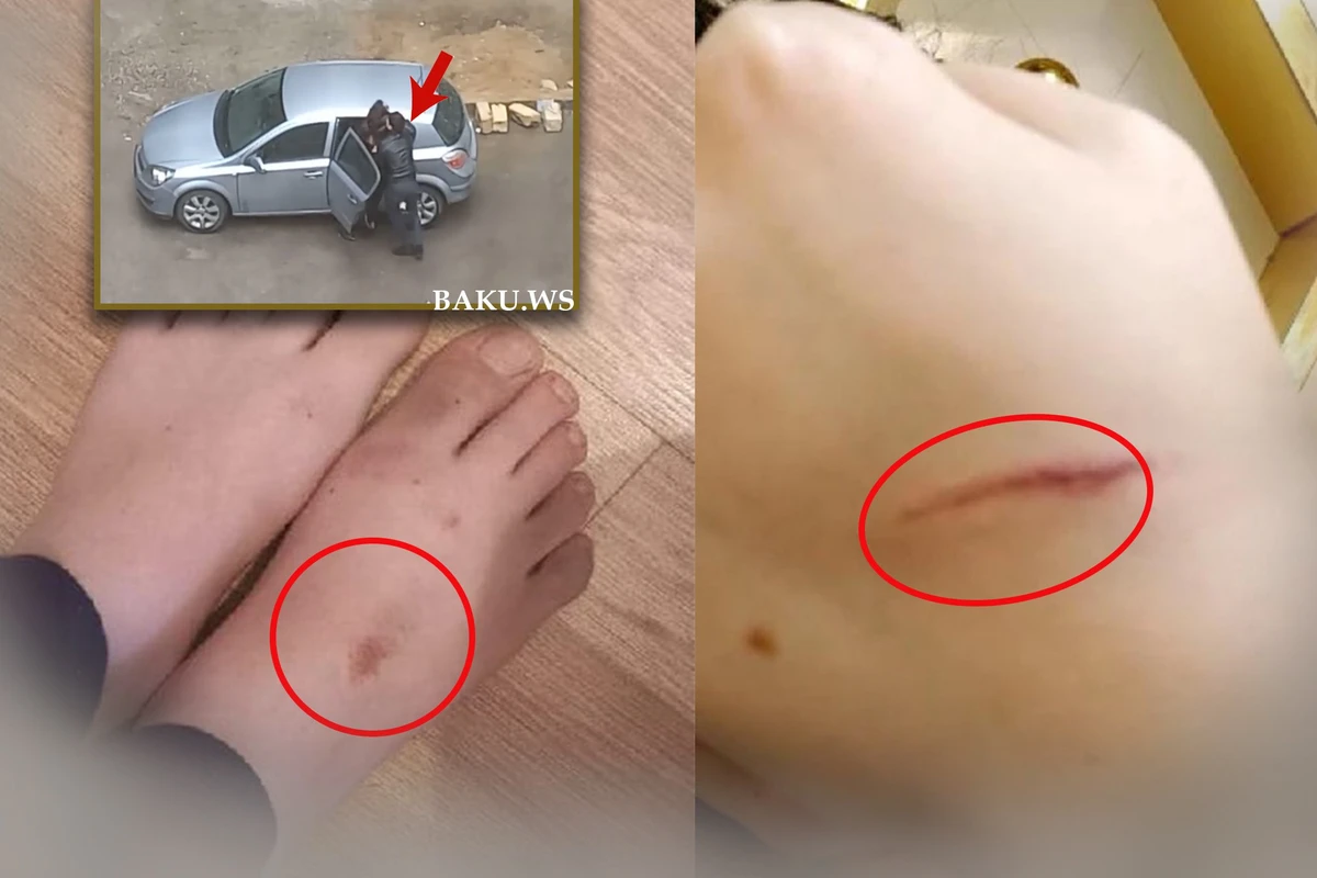 Küçədə qaçırılan qadınla bağlı ŞOK DETALLAR - Gələn gündən şiddət görür - FOTO - YENİLƏNİB