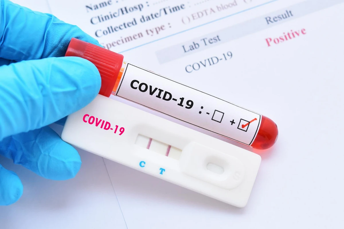 Azərbaycanda daha 17 nəfər COVID-19-a yoluxub, yeddi nəfər vəfat edib