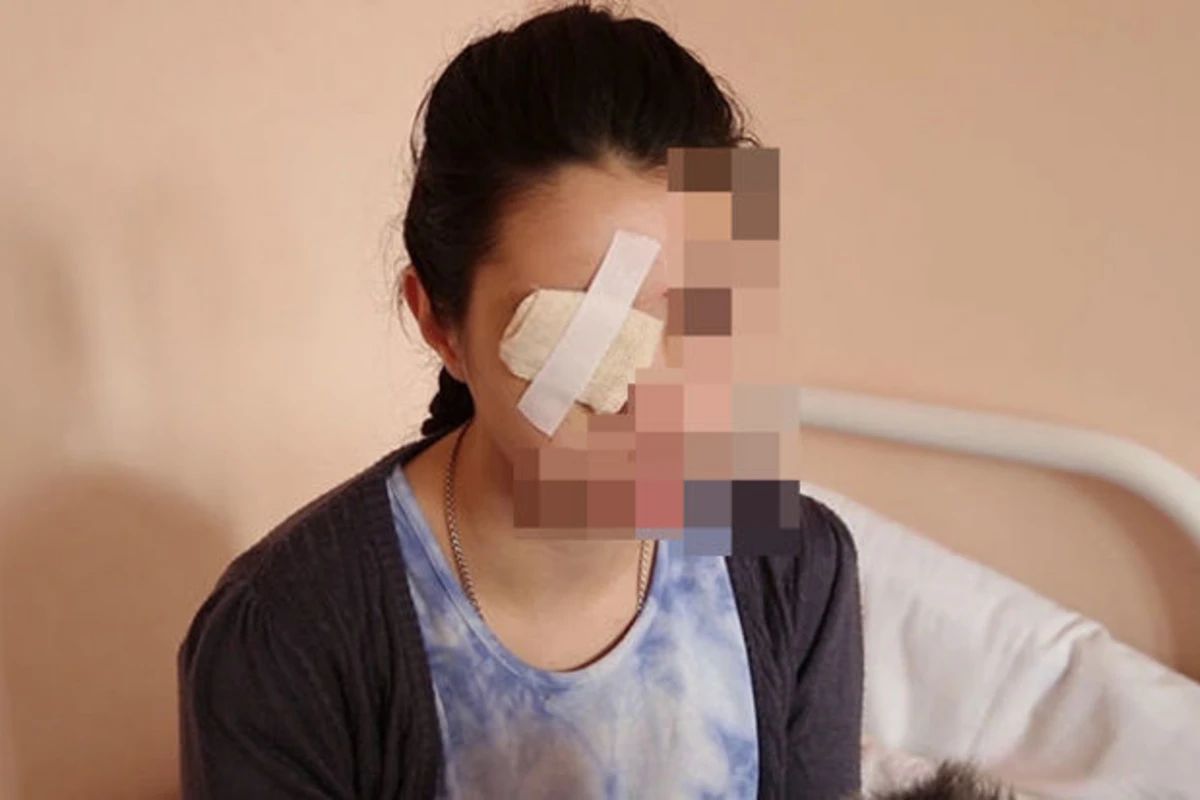Evə taksi ilə gəldiyi üçün döyülən qadın: “Uşaqlar gözümü necə çıxardığını gördülər”