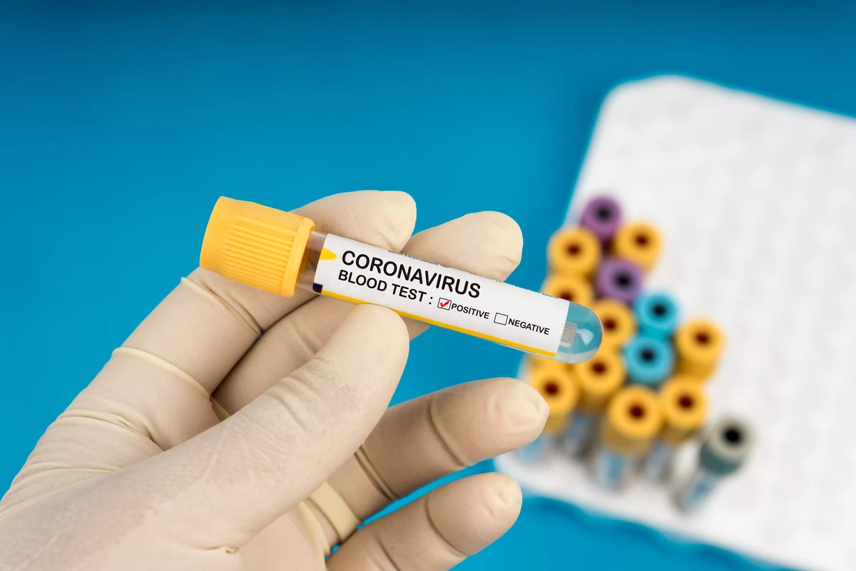 Son sutkada neçə nəfər koronavirusa yoluxub?