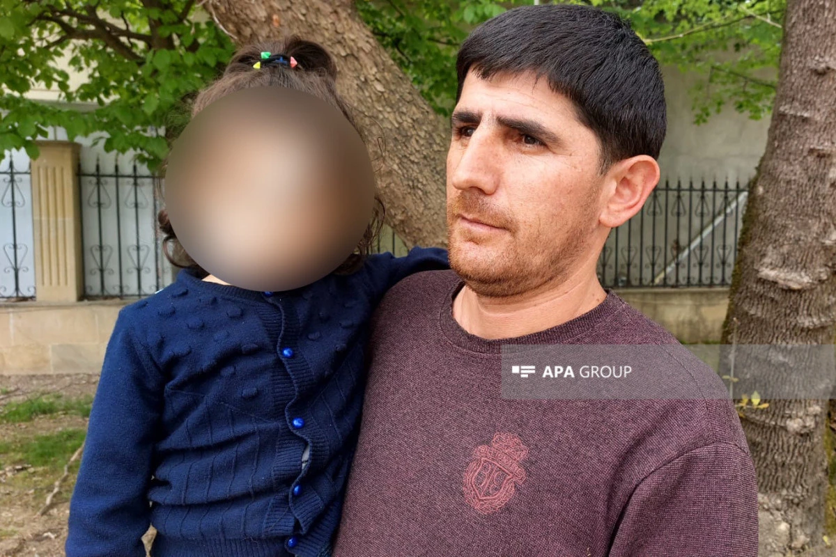 Azərbaycanda it azyaşlını üzündən dişlədi