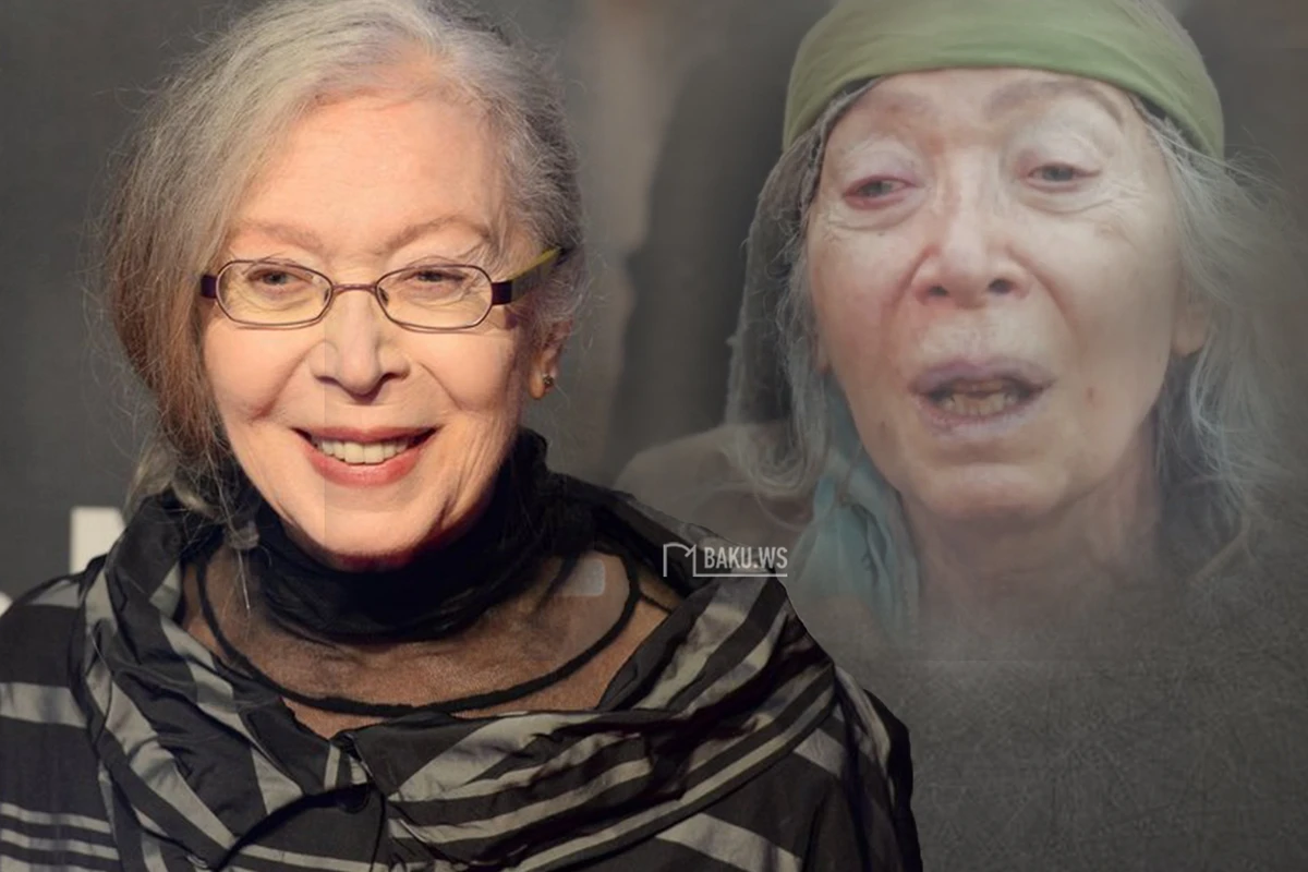 Tanınmış aktrisa kədərləndirdi: Ayaq üstə dayana bilmirəm - FOTO