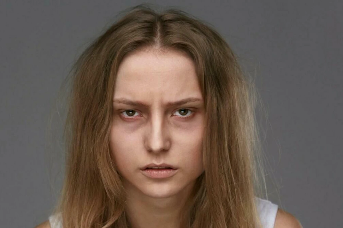 Göz altındakı qara dairələr bu səbəbdən yaranır