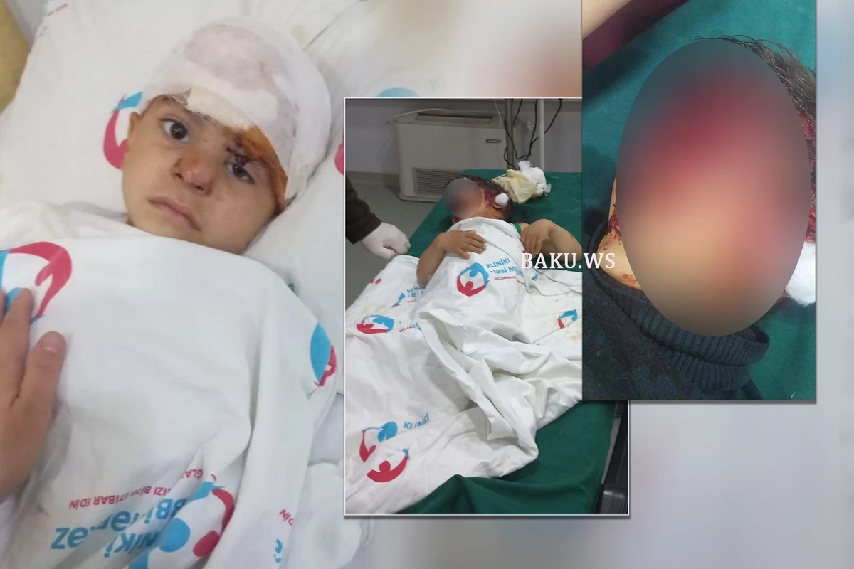 Sahibsiz itlər həyətdə oynayan uşaqlara hücum çəkdilər - İki uşaq ağır xəsarətlər alıb - FOTO
