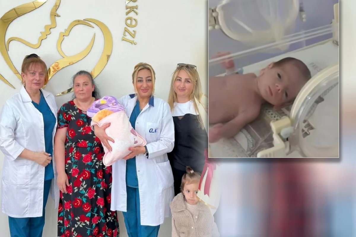 Azərbaycanda 845 qramlıq körpə doğuldu - FOTO/VİDEO