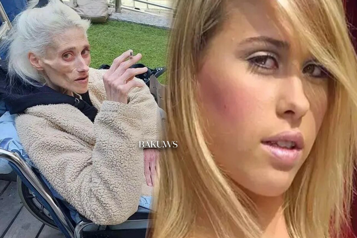 Arıqlamaq istəyən gənc model 24 kq çəkiyə çatıb öldü - FOTO