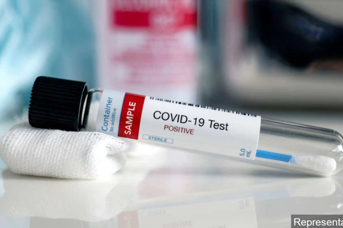 Azərbaycanda COVID-19 statistik hesabatı ilə bağlı yeni QƏRAR