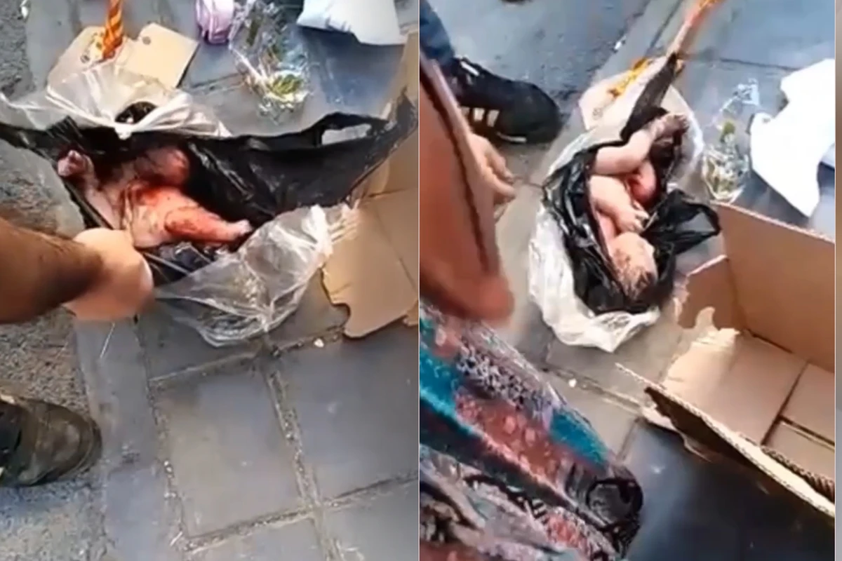 Tehranda zibil qutusuna atılmış körpə tapıldı: Dəhşətli görüntülər - VİDEO