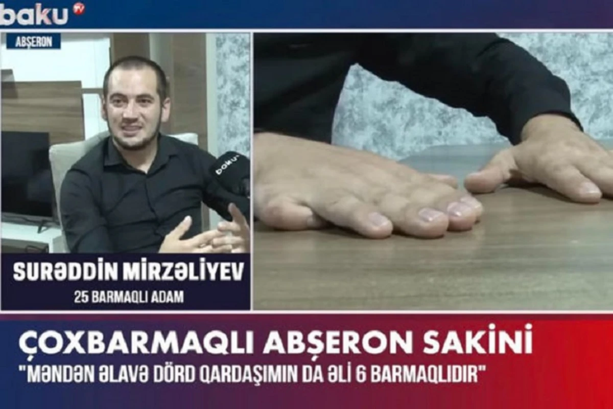 25 barmağa sahib Surəddin: “Mənimlə bərabər, dörd qardaşımın da əllərində altı barmaq var” - VİDEO
