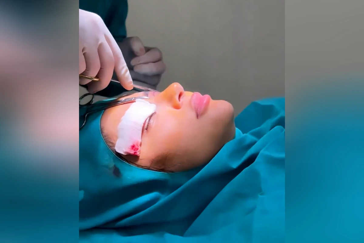 Xəyalə Quliyevanın plastik əməliyyat GÖRÜNTÜLƏRİ - VİDEO