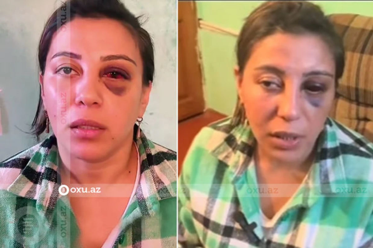 Əri tərəfindən döyülən qadınla bağlı araşdırma başladılıb - VİDEO