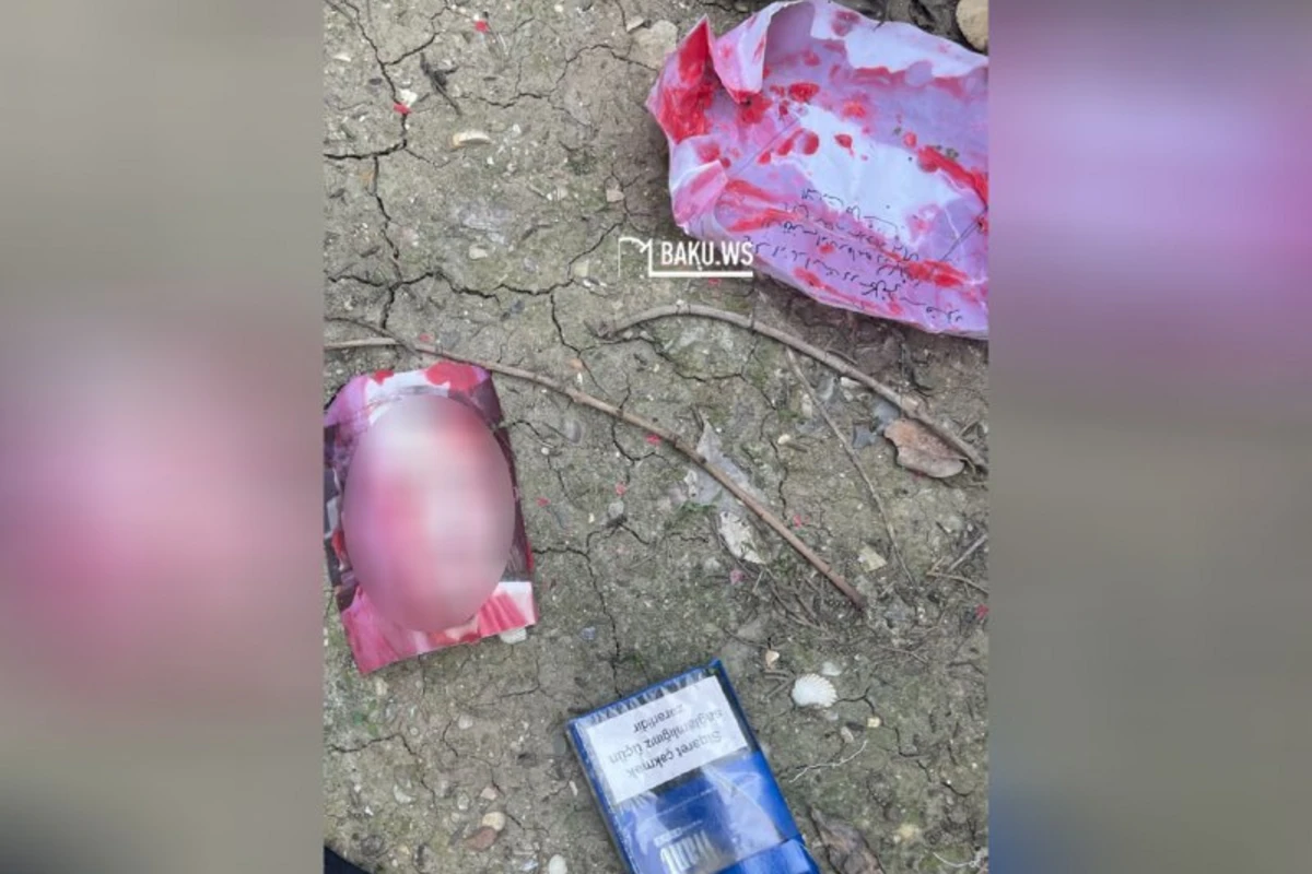 Xırdalan qəbiristanlığında cadu - Qanlı şəkilləri kim atır? – FOTO