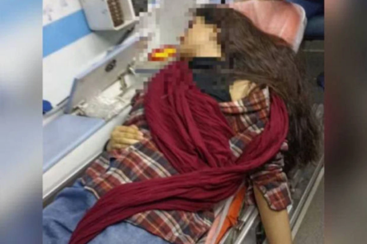 İranda əxlaq polisi daha bir qıza hücum edib - FOTO