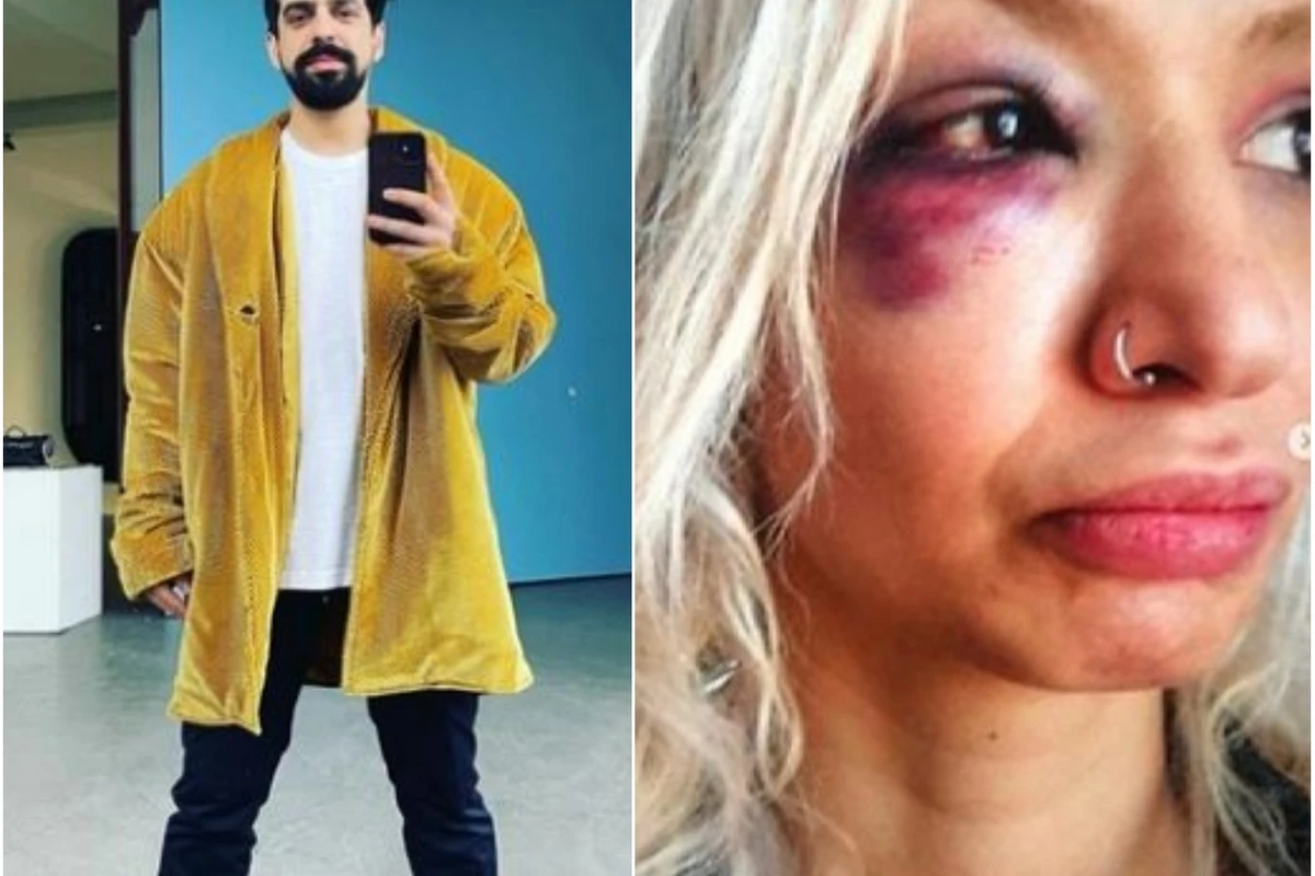 Müğənnini bu hala salan sevgilisi indi də ona GÜLLƏ GÖNDƏRDİ - FOTO Müğənnini bu hala salan sevgilisi indi də ona GÜLLƏ GÖNDƏRDİ - FOTO