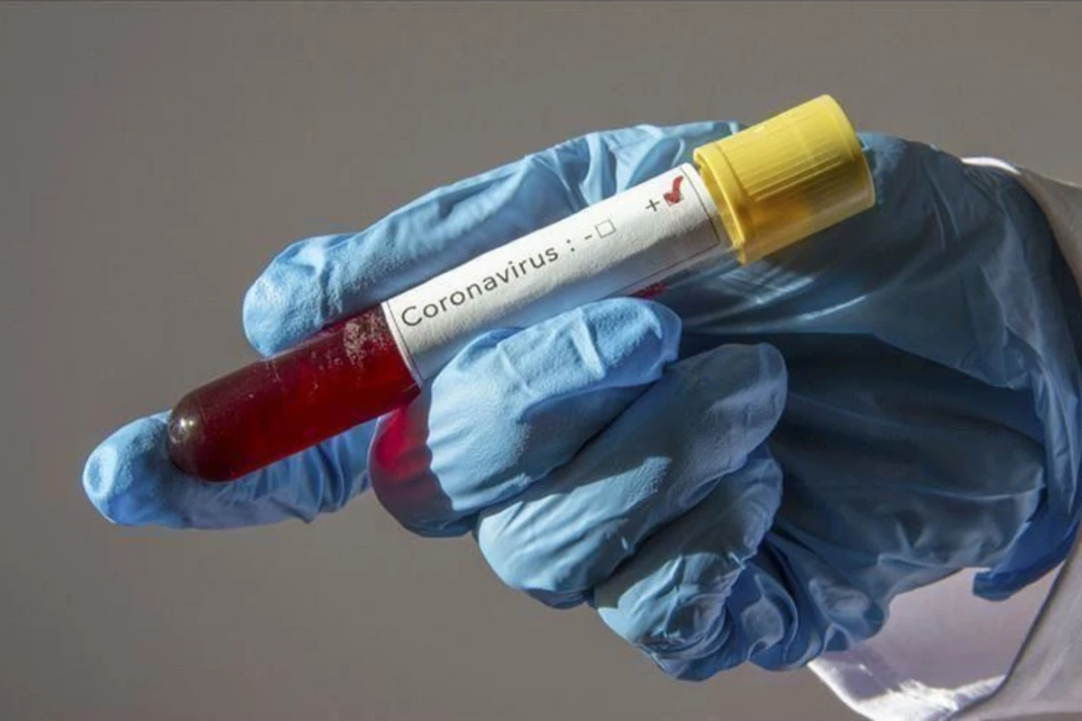 Azərbaycanda 39 koronavirus xəstəsi var