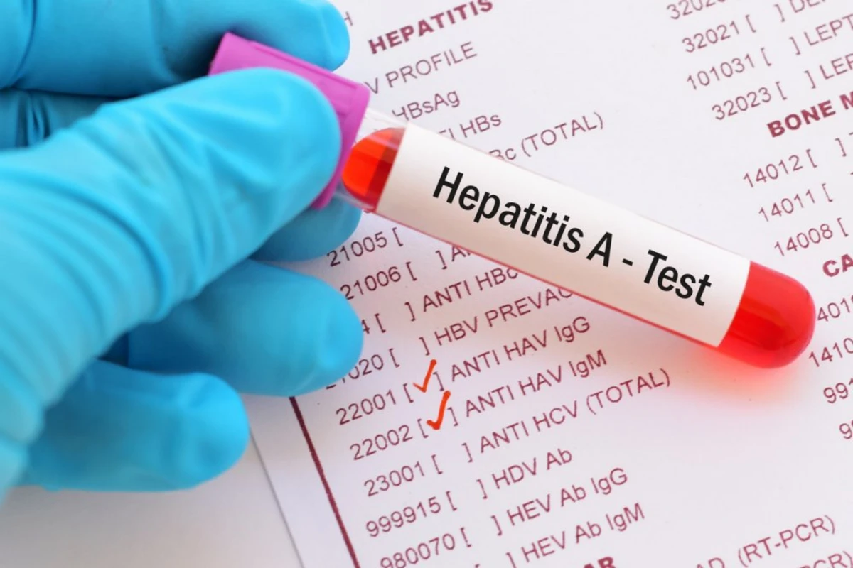 TƏBİB rəsmisi əhalini hepatit A virusuna qarşı vaksinasiyasiya çağırıb