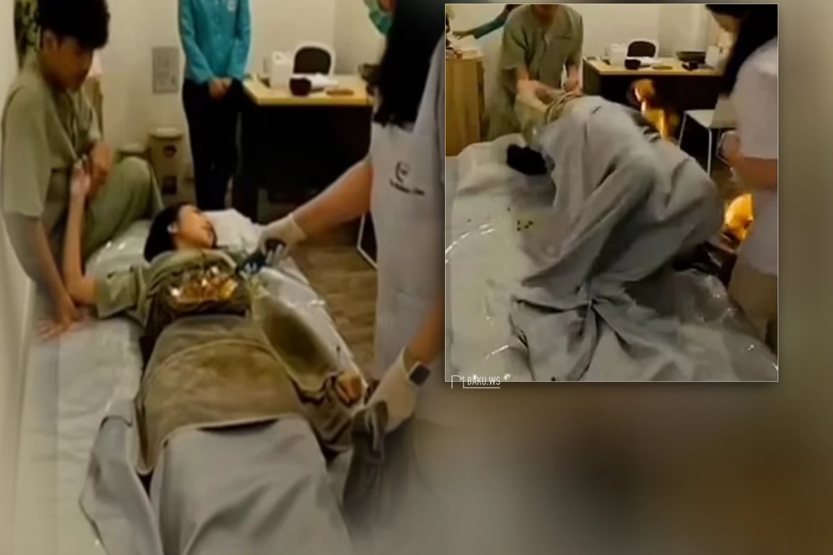 Məşhur model türkəçarə zamanı od tutub yandı - FOTO/VİDEO