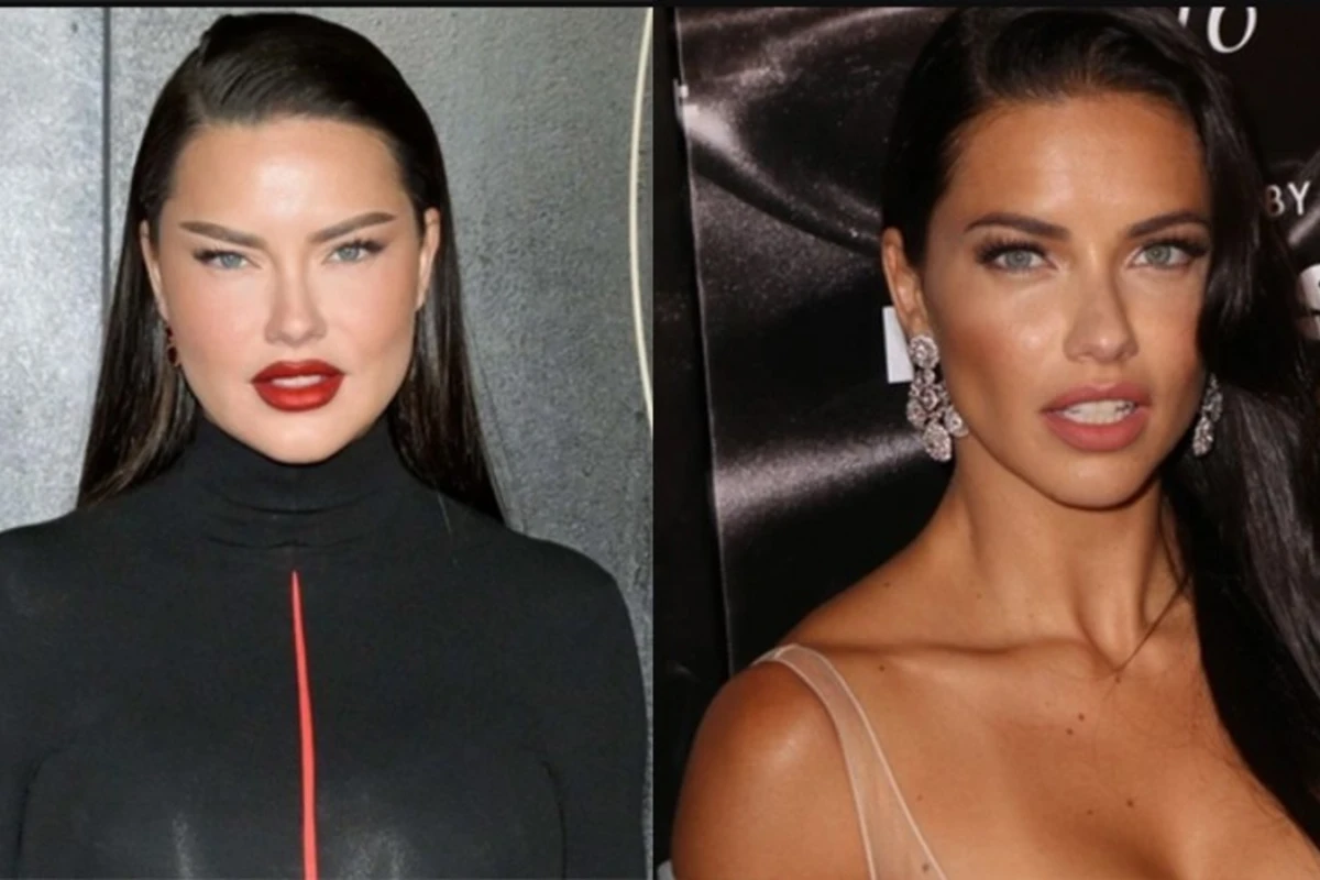 Adriana Lima estetik etdirib? - AÇIQLAMA - FOTO