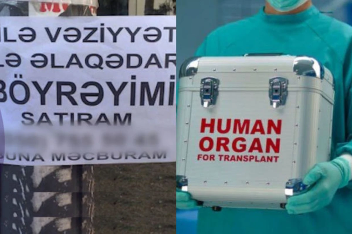 Orqan satışı elanlarını yayanlar kimlərdir? - VİDEO Orqan satışı elanlarını yayanlar kimlərdir? - VİDEO