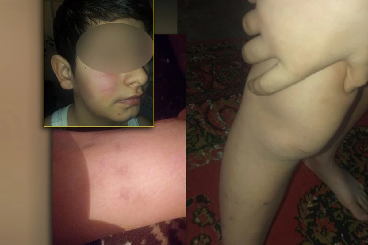 В Азербайджане мужчина избил 10-летнего мальчика - ВИДЕО