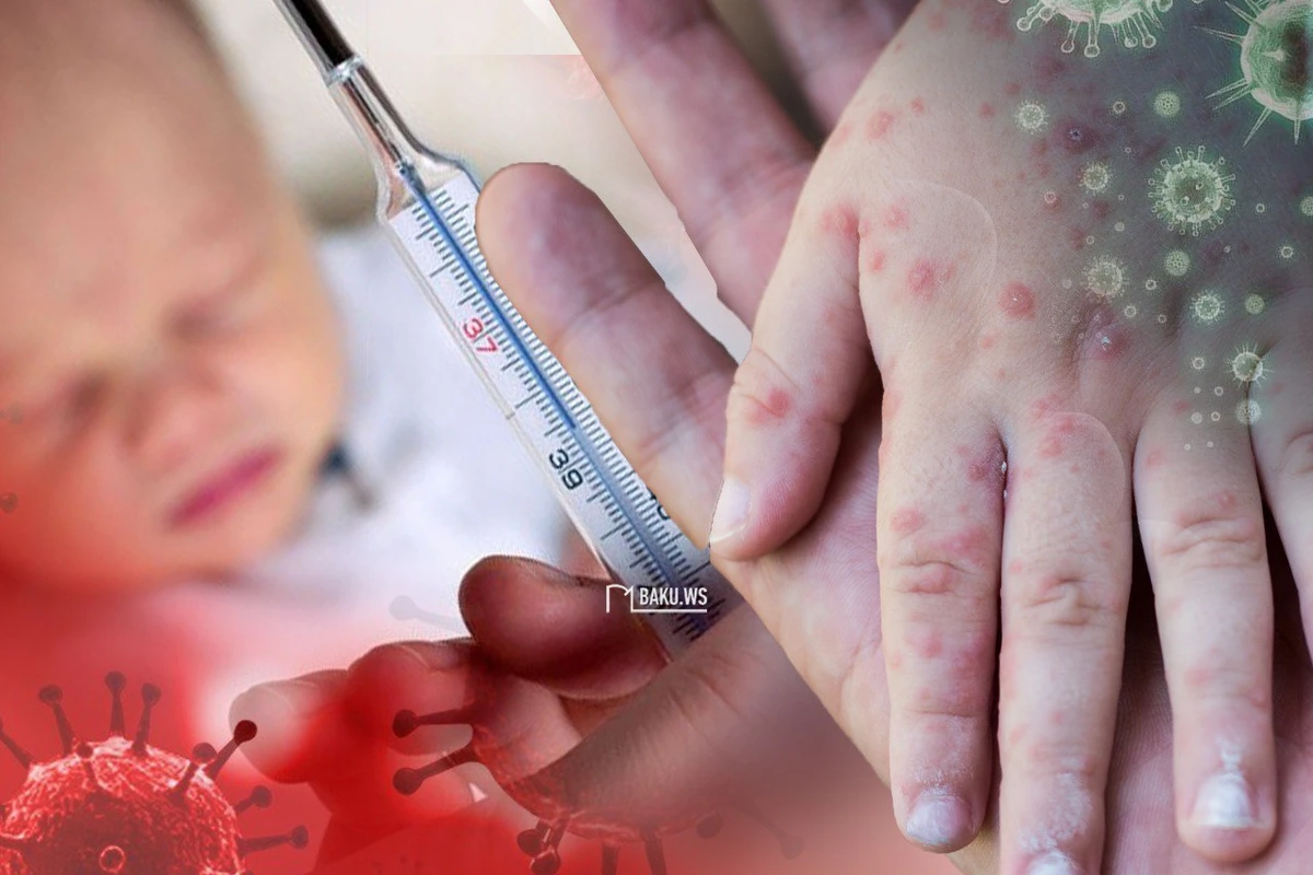 Nə üçün qızılcadan ölənlərin sayı artır?  - AÇIQLAMA - VİDEO