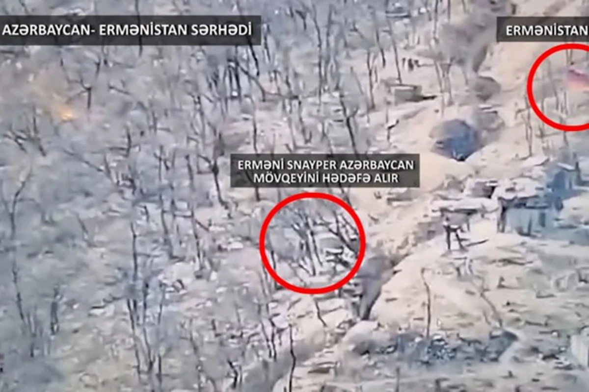 Военнослужащего, получившего ранения в результате армянской провокации, прооперировали - ВИДЕО