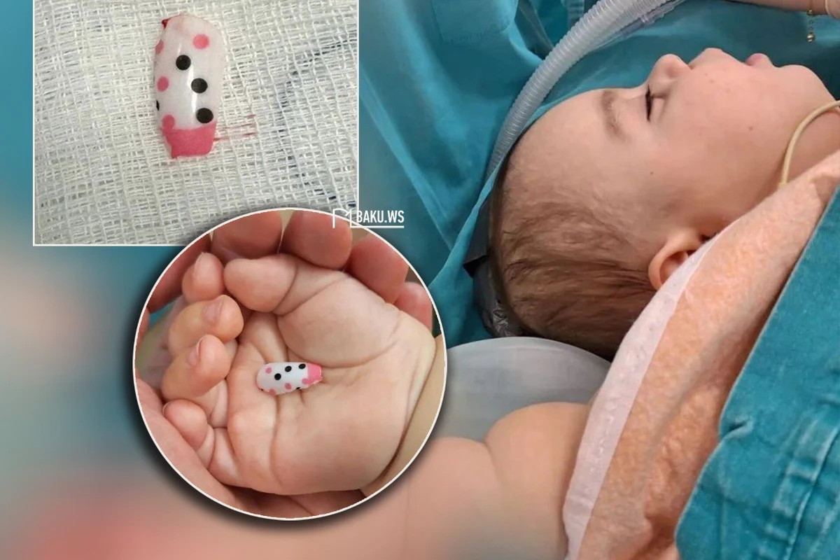 Bacısının plastik dırnağı 6 aylıq körpəni xəstəxanalıq etdi - FOTO